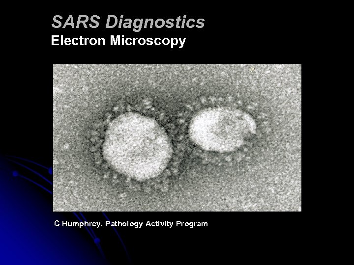 SARS Diagnostics Electron Microscopy C Humphrey, Pathology Activity Program 