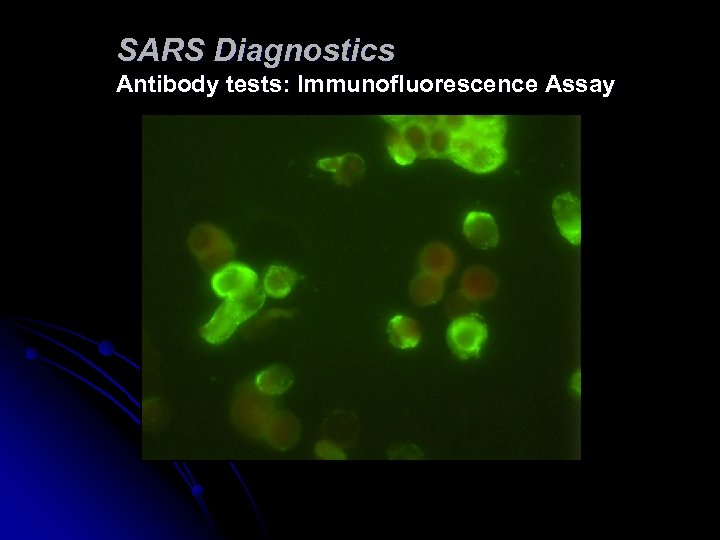 SARS Diagnostics Antibody tests: Immunofluorescence Assay 