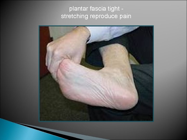 plantar fascia tight stretching reproduce pain 