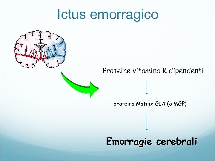 Ictus emorragico Proteine vitamina K dipendenti proteina Matrix GLA (o MGP) Emorragie cerebrali 