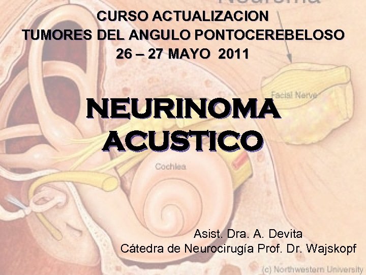 CURSO ACTUALIZACION TUMORES DEL ANGULO PONTOCEREBELOSO 26 – 27 MAYO 2011 NEURINOMA ACUSTICO Asist.