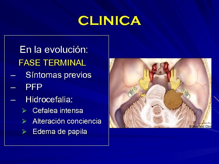 CLINICA En la evolución: FASE TERMINAL – Síntomas previos – PFP – Hidrocefalia: Ø