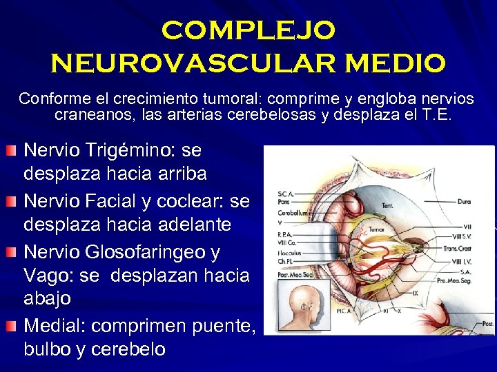 COMPLEJO NEUROVASCULAR MEDIO Conforme el crecimiento tumoral: comprime y engloba nervios craneanos, las arterias