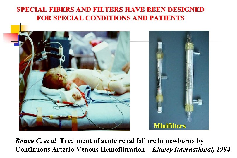 SPECIAL FIBERS AND FILTERS HAVE BEEN DESIGNED FOR SPECIAL CONDITIONS AND PATIENTS Minifilters Ronco