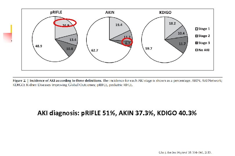 AKI diagnosis: p. RIFLE 51%, AKIN 37. 3%, KDIGO 40. 3% 