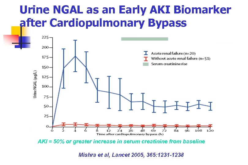 Urine NGAL as an Early AKI Biomarker after Cardiopulmonary Bypass AKI = 50% or