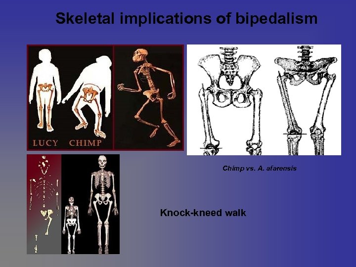 Skeletal implications of bipedalism Chimp vs. A. afarensis Knock-kneed walk 