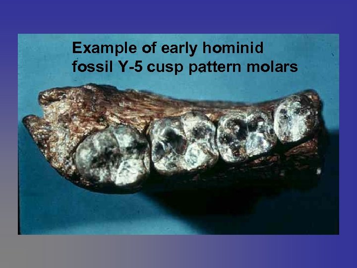 Example of early hominid fossil Y-5 cusp pattern molars 
