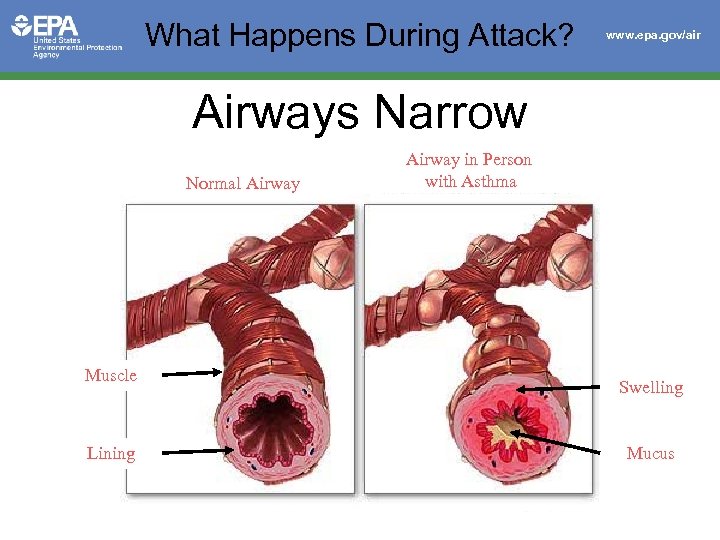 What Happens During Attack? www. epa. gov/air Airways Narrow Normal Airway Muscle Lining Airway