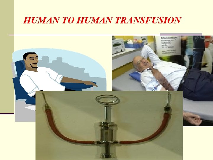 HUMAN TO HUMAN TRANSFUSION 