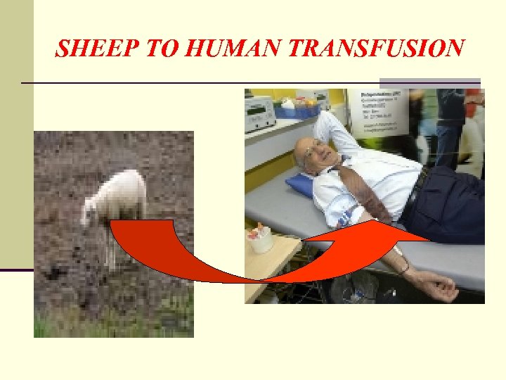 SHEEP TO HUMAN TRANSFUSION 