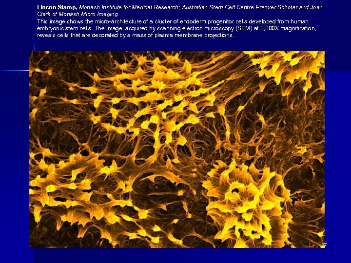 Lincon Stamp, Monash Institute for Medical Research; Australian Stem Cell Centre Premier Scholar and