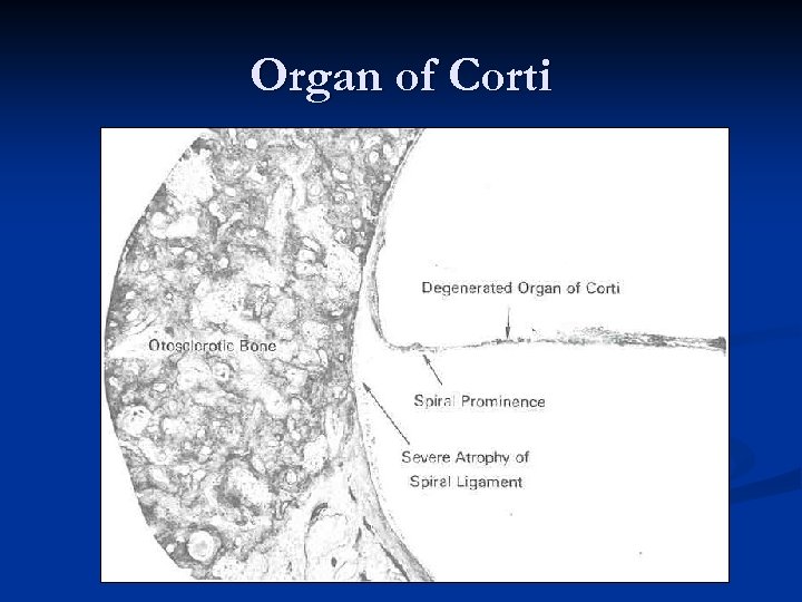 Organ of Corti 