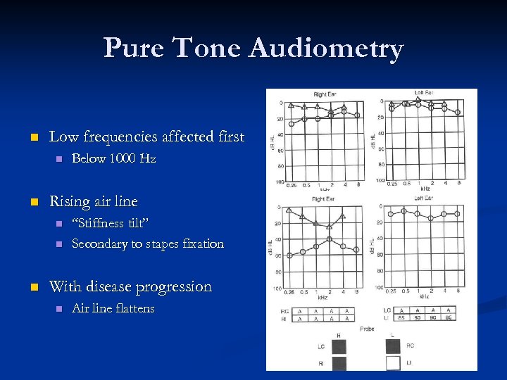 Pure Tone Audiometry n Low frequencies affected first n n Rising air line n