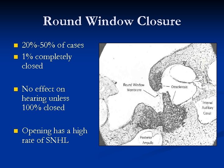 Round Window Closure n n 20%-50% of cases 1% completely closed n No effect