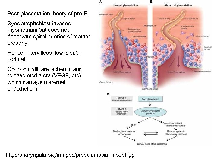 Poor-placentation theory of pre-E: Synciotrophoblast invades myometrium but does not denervate spiral arteries of