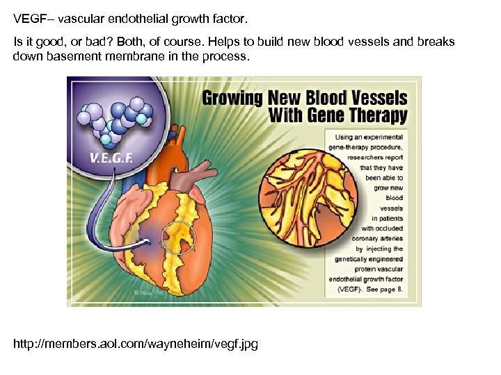 VEGF– vascular endothelial growth factor. Is it good, or bad? Both, of course. Helps