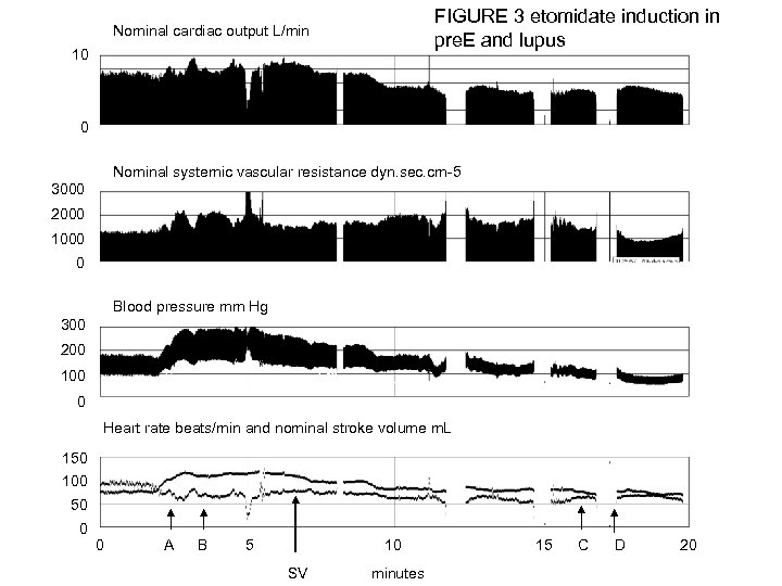 FIGURE 3 etomidate induction in pre. E and lupus Nominal cardiac output L/min 10