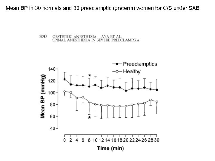 Mean BP in 30 normals and 30 preeclamptic (preterm) women for C/S under SAB