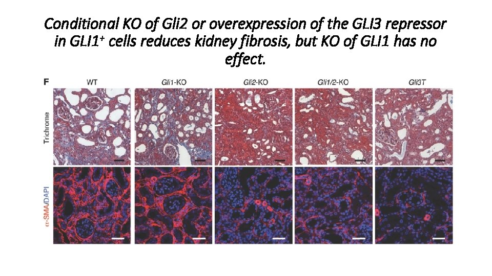 Conditional KO of Gli 2 or overexpression of the GLI 3 repressor in GLI