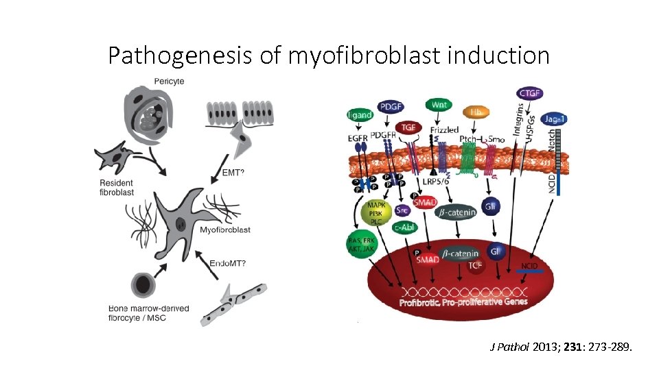 Pathogenesis of myofibroblast induction J Pathol 2013; 231: 273 -289. 