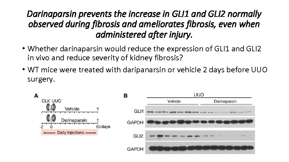 Darinaparsin prevents the increase in GLI 1 and GLI 2 normally observed during fibrosis