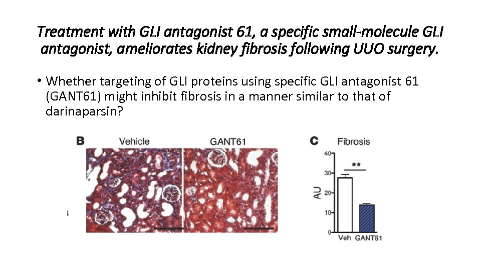 Treatment with GLI antagonist 61, a specific small-molecule GLI antagonist, ameliorates kidney fibrosis following