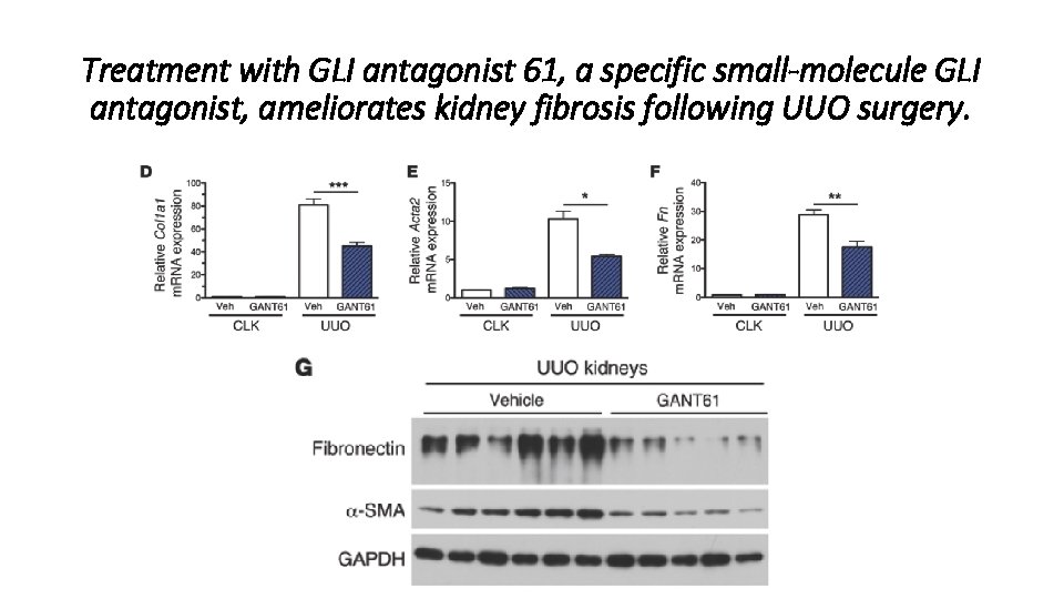 Treatment with GLI antagonist 61, a specific small-molecule GLI antagonist, ameliorates kidney fibrosis following