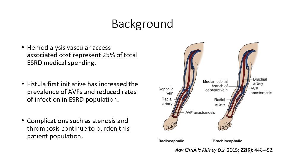 Background • Hemodialysis vascular access associated cost represent 25% of total ESRD medical spending.