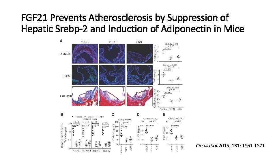 FGF 21 Prevents Atherosclerosis by Suppression of Hepatic Srebp-2 and Induction of Adiponectin in