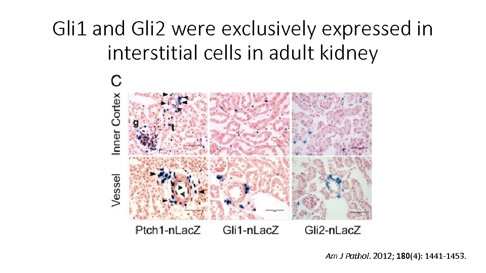 Gli 1 and Gli 2 were exclusively expressed in interstitial cells in adult kidney