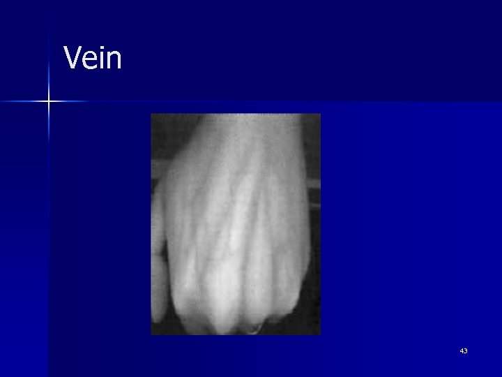 Vein 43 