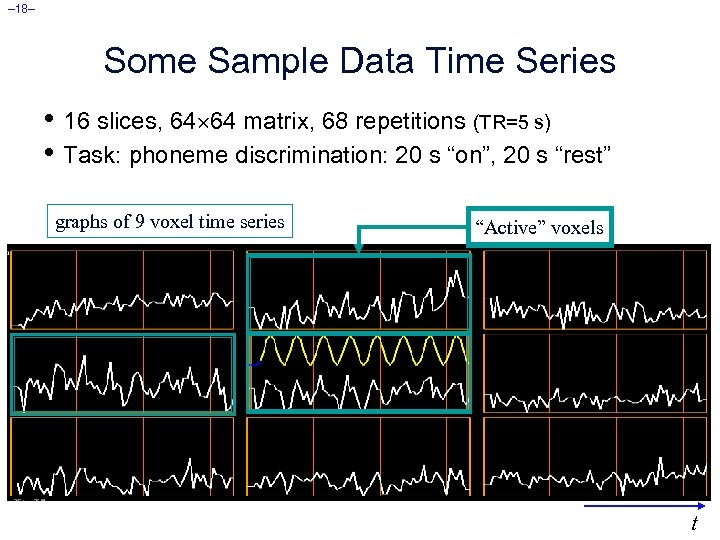 – 18– Some Sample Data Time Series • 16 slices, 64 64 matrix, 68