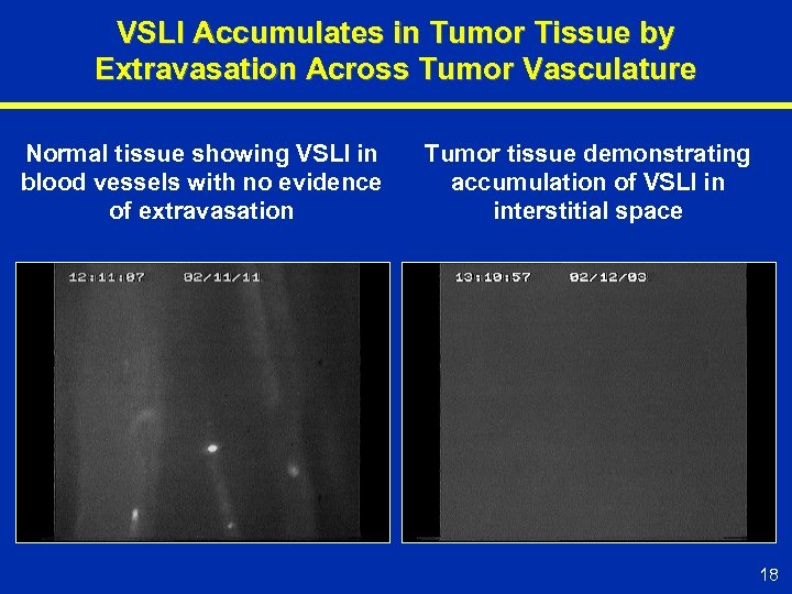 VSLI Accumulates in Tumor Tissue by Extravasation Across Tumor Vasculature Normal tissue showing VSLI