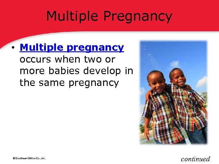 Multiple Pregnancy • Multiple pregnancy occurs when two or more babies develop in the