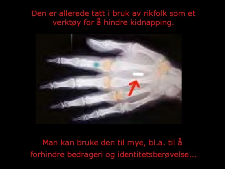 Den er allerede tatt i bruk av rikfolk som et verktøy for å hindre