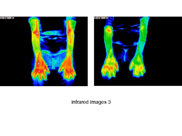 Infrared Images 3 