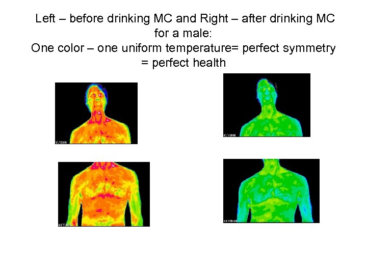 Left – before drinking MC and Right – after drinking MC for a male: