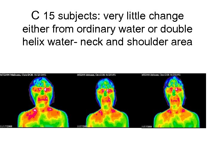 C 15 subjects: very little change either from ordinary water or double helix water-