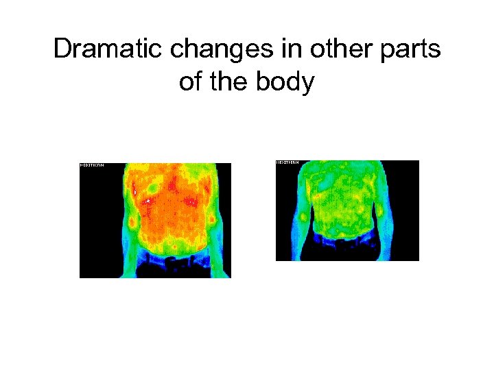 Dramatic changes in other parts of the body 