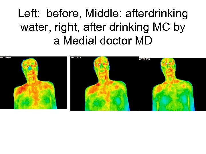 Left: before, Middle: afterdrinking water, right, after drinking MC by a Medial doctor MD