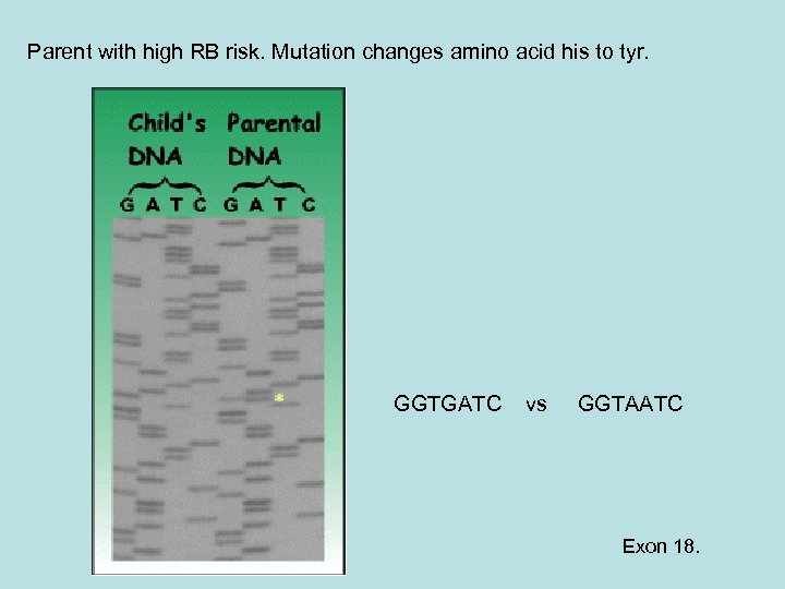 Parent with high RB risk. Mutation changes amino acid his to tyr. GGTGATC vs
