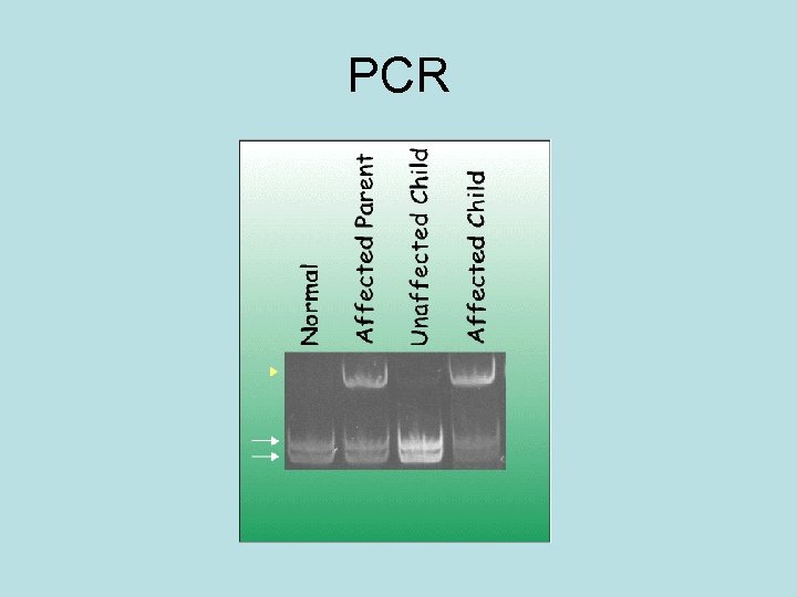 PCR 
