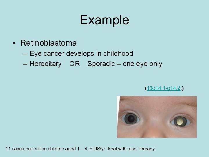 Example • Retinoblastoma – Eye cancer develops in childhood – Hereditary OR Sporadic –