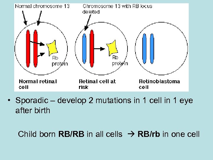  • Sporadic – develop 2 mutations in 1 cell in 1 eye after