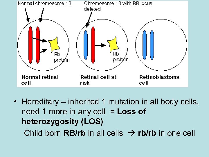  • Hereditary – inherited 1 mutation in all body cells, need 1 more