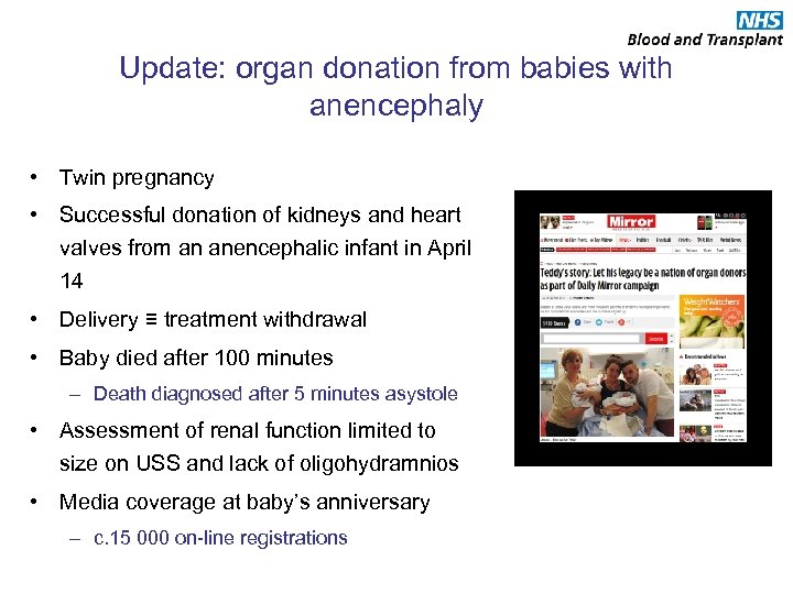 Update: organ donation from babies with anencephaly • Twin pregnancy • Successful donation of