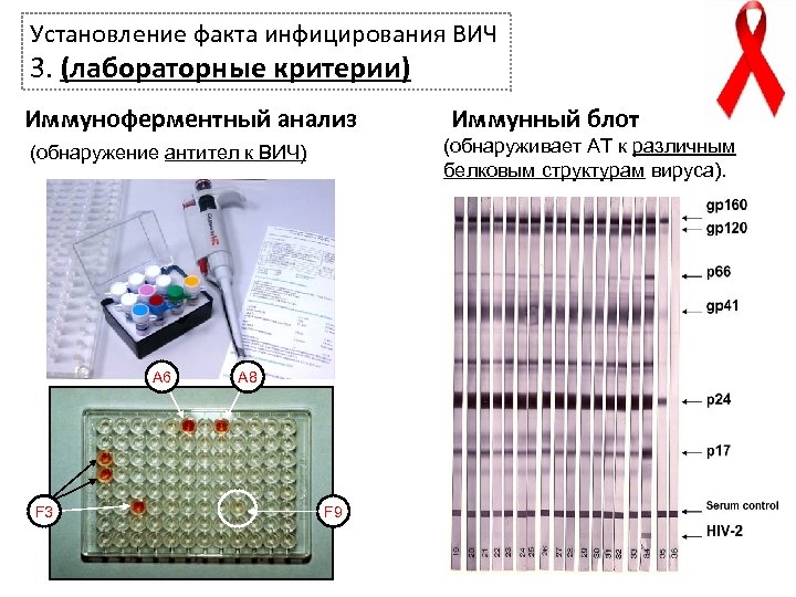 Установление факта инфицирования ВИЧ 3. (лабораторные критерии) Иммуноферментный анализ (обнаруживает АТ к различным белковым
