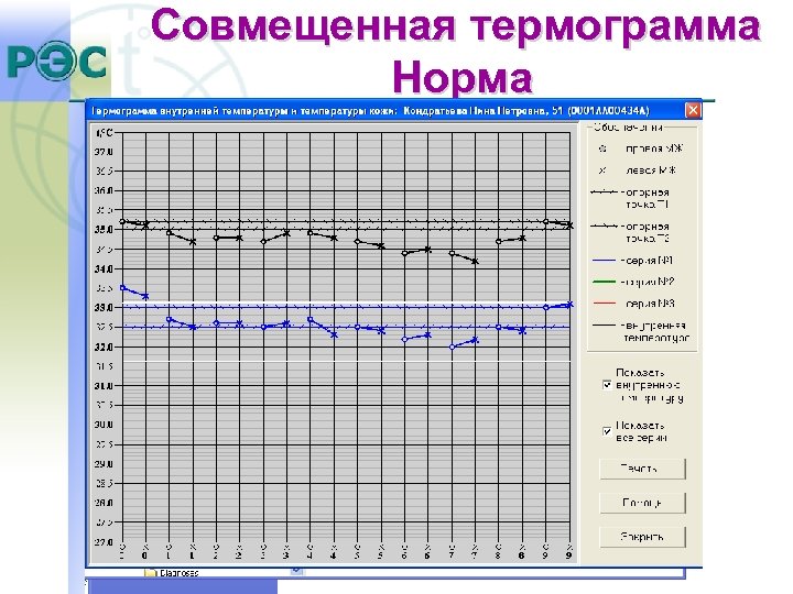Совмещенная термограмма Норма 