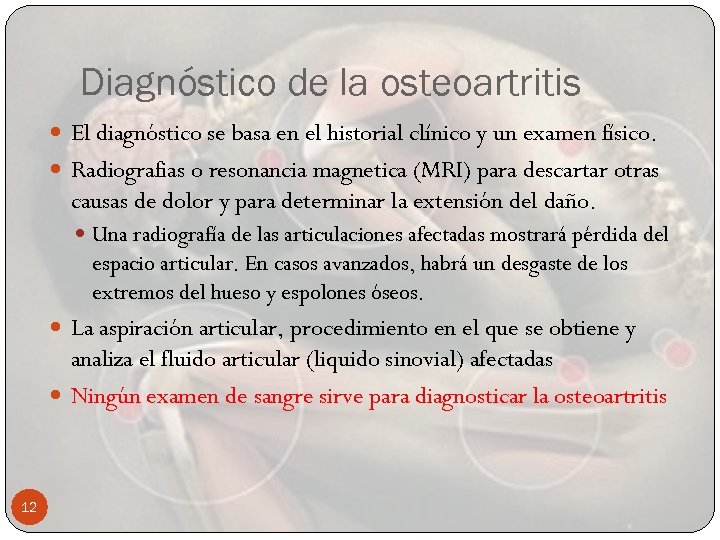 Diagnóstico de la osteoartritis El diagnóstico se basa en el historial clínico y un